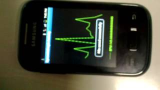 AABSyS Android ECG plot