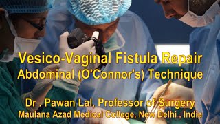 Vesico vaginal fistula   Dr  Pawan Lal