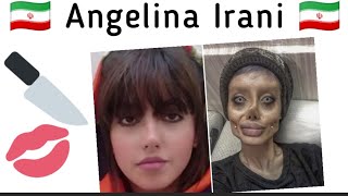 Iranian Angelina Jolie Instagram Star Jailed- Has Cosmetic Surgery Gone Too Far In The Middle East?