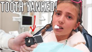 Tooth Yanked Out with Pliers 😮 | Clearing Space for Braces