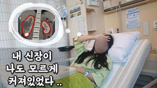 [입원 vlog] 혈뇨이슈로 응급실에 갔더니 신장에 신장보다 큰 혹이 있다고?  | 응급실부터 대학병원 수술까지 | 신장결석 제거술 |