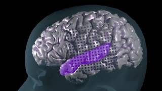 Onset and Sustained Maps in Human Speech Cortex/ Curr. Biol., May 31, 2018 (Vol. 28, Issue 12)