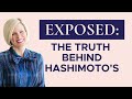 What is Hashimoto's Disease?