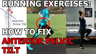 Running Exercises: How to fix Anterior Pelvic Tilt to RUN FASTER!