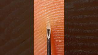 Needle stick injury visualized up close! #microscope #anatomy #skincare #science #medical