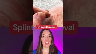 Splinter Removal