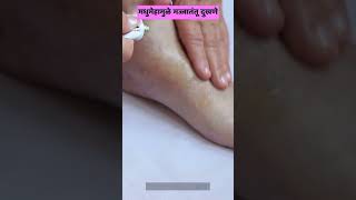 मधुमेहामुळे पाय दुखणे | मधुमेहामुळे पाय दुखणे टाळा | Diabetic Neuropathy