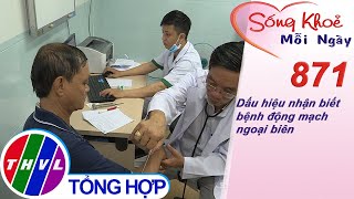 Dấu hiệu nhận biết bệnh động mạch ngoại biên | Sống khỏe mỗi ngày - Kỳ 871