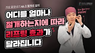 [ 거상수술 끝장내기 ] 제 3강. 안면거상 절개선의 위치 및 길이에 따른 거상 효과