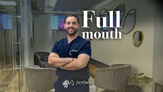 Full Mouth Smile Makeover — Transform Your Smile in Costa Rica