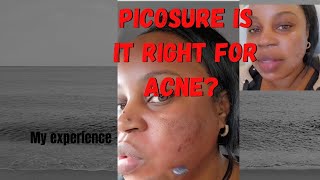 THINGS I WISHED I KNEW BEFORE PICOSURE|MY EXPERIENCE |DID IT WORK⁉️🤔