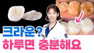 치과 여러 번 오실 필요 없습니다! 단 하루로 끝내는 크라운 세팅!