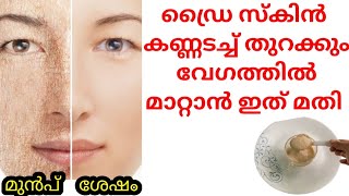 ഡ്രൈ സ്കിൻ കണ്ണടച്ചു തുറക്കും വേഗത്തിൽ Natural ആയി മാറ്റാൻ ഇങ്ങനെ ചെയ്യു  195