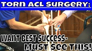 Torn ACL Surgery; Want Best Success- Must See This!