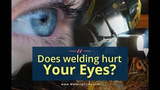 Can WELDING really make you BLIND?#viral @jhwconcepts711