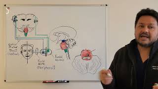 Facial Nerve Palsy (2) - central causes, Millard-Gubler syndrome, and Foville syndrome