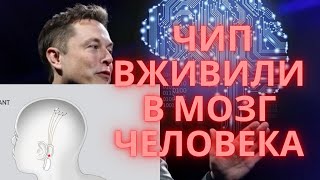 Первый чип Neuralink в мозгу человека! Компания Neuralink Илона Маска