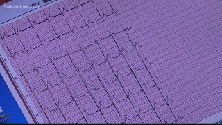 Florida bill would require EKGs for student athletes
