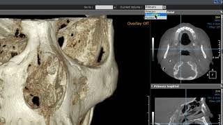 [OnDemand] 3D Ceph (Compare)