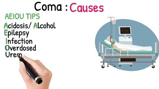 Coma Causes | What Are The Causes Of Comatosed or Unconscious Patients