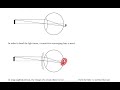 physics 001 notes p77 78 the human eye and correction of vision problems