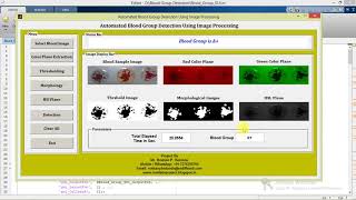 Matlab Code for Blood Group Detection using Image Processing