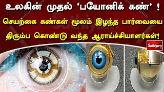 உலகின் முதல் ‘பயோனிக் கண்‘ ! செயற்கை கண்கள்மூலம் இழந்த பார்வையை திரும்ப கொண்டுவந்த ஆராய்ச்சியாளர்கள்