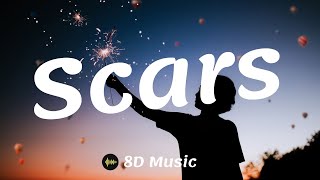 Lukas Graham - Scars (8D Music)