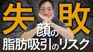 【知らないとヤバい】顔の脂肪吸引の失敗やリスクについてプロが解説！