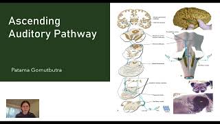 Ascending auditory