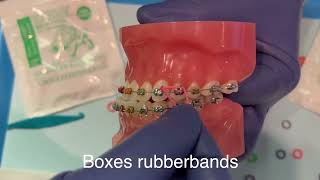Braces: How to do Boxes Rubber bands