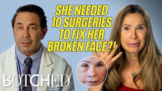 Michelle’s Face Was Shattered and Paralyzed After Being Kicked By A Horse | Rejected By Botched | E!