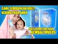 CARA SEMBUHKAN KULIT KERING PADA ANAK