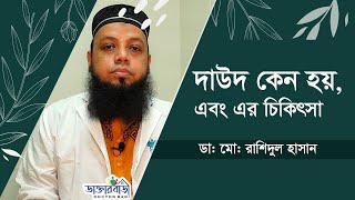 দাউদ কেন হয়, এবং এর চিকিৎসা।ডাঃ মোঃ রাশিদুল হাসান। ডাক্তার বাড়ী Doctor Bari, Health Tips