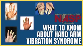 Hand Arm Vibration Syndrome – Causes and Prevention