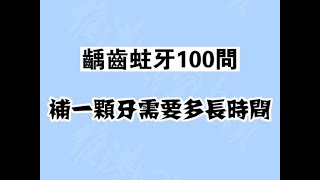 【珠海維港口腔科普】補一顆牙需要多長時間？