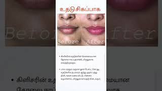 உதடு சிகப்பாக /beauty tips in tamil