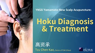 YNSA Yamamoto New Scalp Acupuncture: Demonstration of Hoku Diagnosis \u0026 Acupuncture Treatment