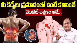 Dr Bhushan Raju - మీ కిడ్నీలు ప్రమాదంలో ఉంటే కనిపించే లక్షణాలు | Kidney Disease Symptoms | iDream