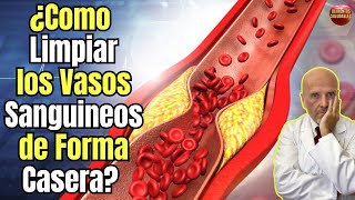 💝 ¿COMO LIMPIAR LOS VASOS SANGUINEOS DE FORMA CASERA? 💝