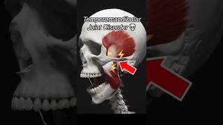 Temporomandibular Joint Dysfunction (TMJ + TMD)