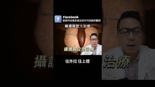 攝護腺超微創治療。攝護腺拉提大解析！誰適合？效果如何？一次搞懂. 林口長庚醫院泌尿外科侯鎮邦醫師  #攝護腺肥大