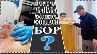 ЖУДА ФОЙДАЛИ МАСЛАХАТ КАНДАЙ КАСАЛАРГА ФОЙДА ХАМА УЧУН