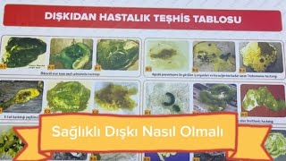 Dışkıdan hastalık teşhisi Sağlıklı dışkı nasıl olmalı