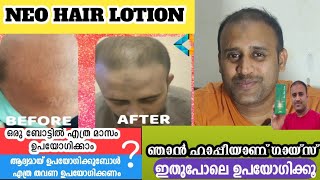 #Neo-Hair-Lotion | how to use | 5 മാസം എത്ര ബോട്ടിൽ ഉപയോഗിക്കാം | OG എങ്ങിനെ മനസ്സിലാക്കാം  | NBRK