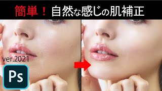 Photoshop| Easy way to How to Retouch Skin