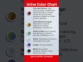 Urine Color Chart Diagnosis #urinecolor #urine #urineanalysis #urineproblem