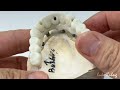 replicating the thickness of natural teeth