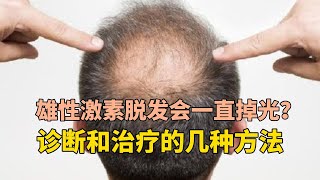 雄激素性脱发会一直掉光吗？雄性激素脱发的诊疗方法？