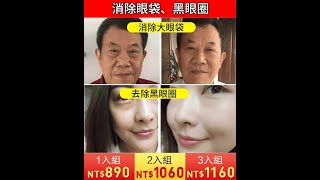 【日韓爆火】多效修護眼霜【賣爆啦】 $1060買一送一！ 脂肪粒/眼紋/黑眼圈/眼袋， 一瓶全搞定！用了眼睛年輕二十歲！